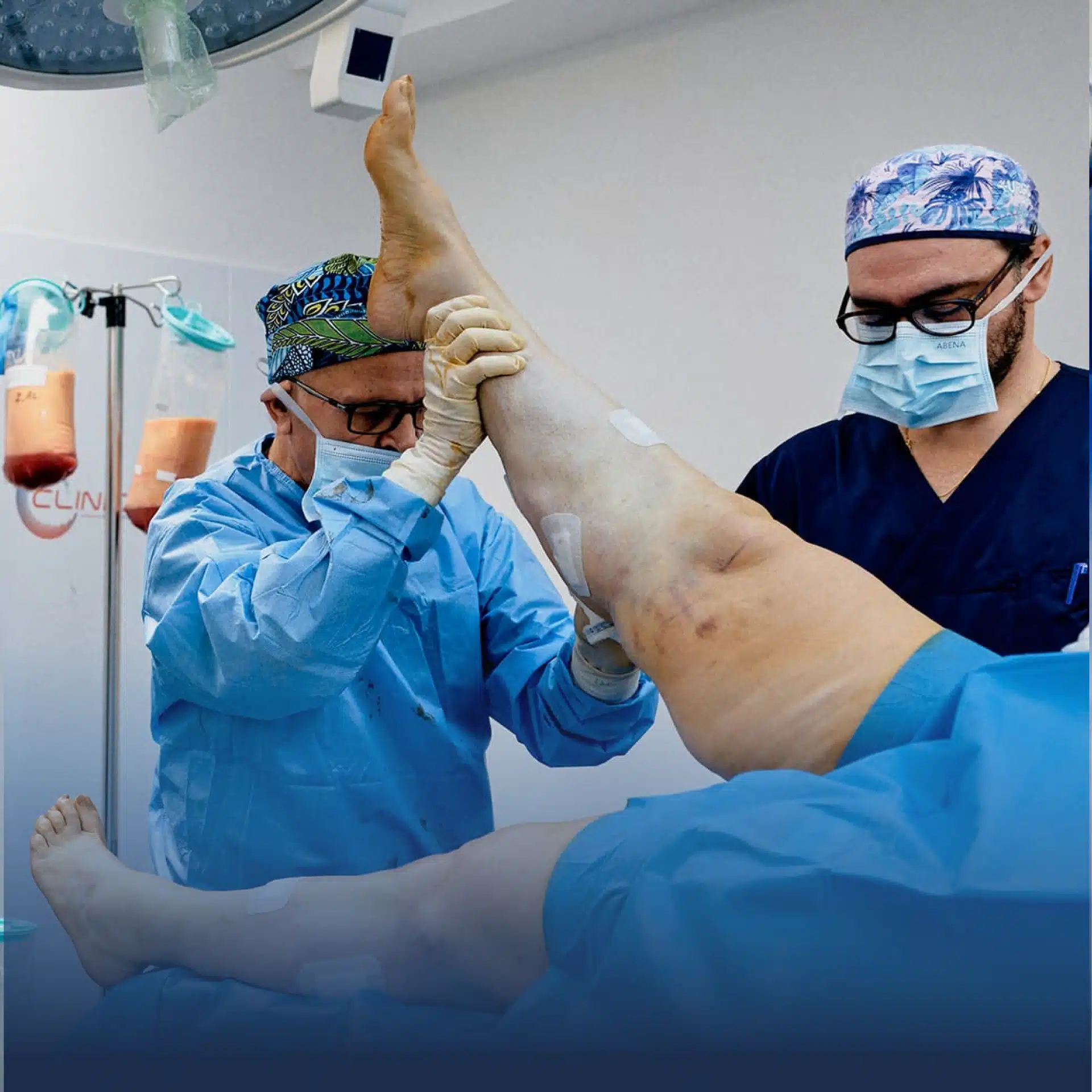 clinique-esthetique-paris-etoile-chirurgie-cliniuque-du-lipoedeme