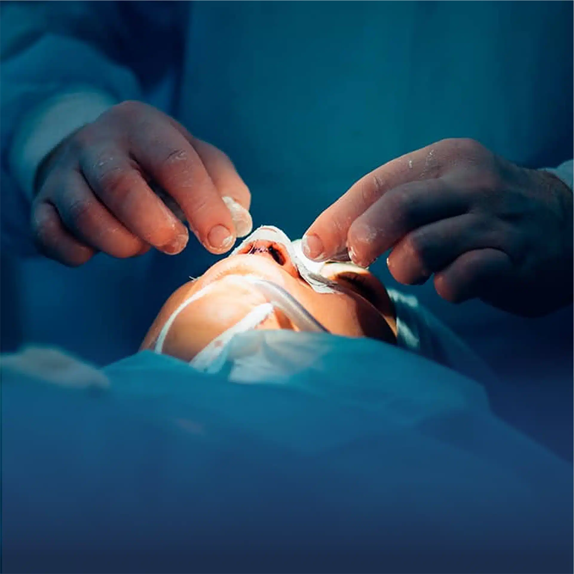 clinique-esthetique-paris-etoile-rhinoplasty-surgery